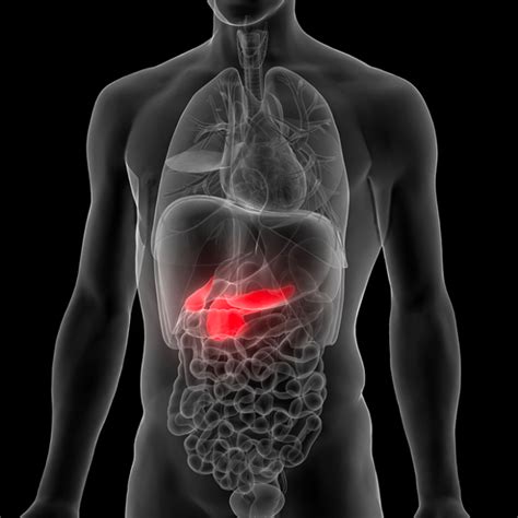 tumore al pancreas non operabile